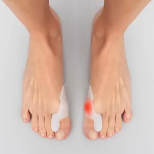 Ochranné silikonové korektory na vybočené palce Bunilief - 2 ks - InnovaGoods